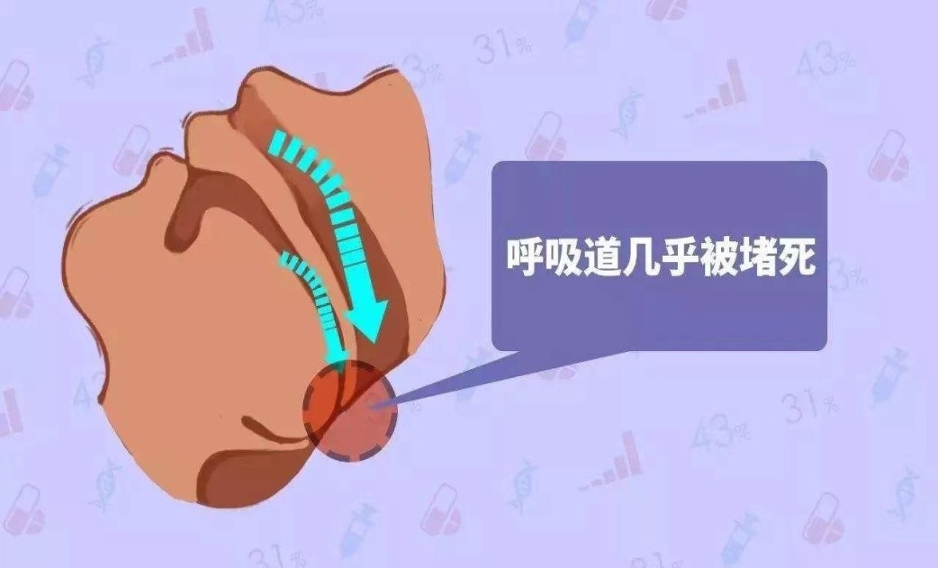 打呼嚕3.jpg